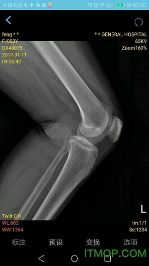 飞图影像医生端