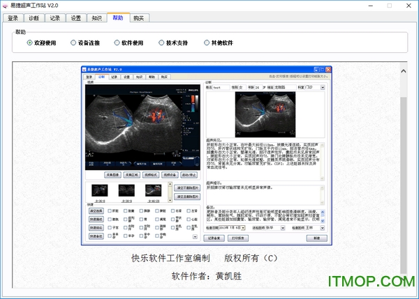 易捷超声工作站