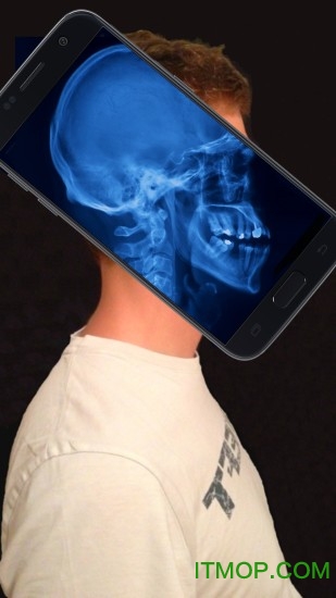 X射线身体扫描模拟器软件下载