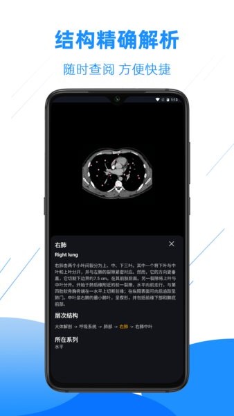 影像解剖图谱app