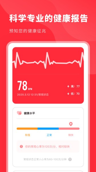 口袋心电图app