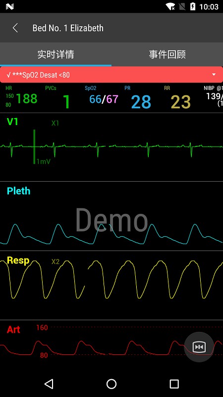 Mobile Viewer(胎心监护仪)